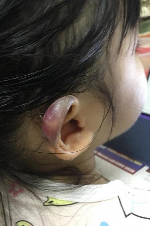 Cops investigating after 3-year-old girl suffers ‘horrific bruise’