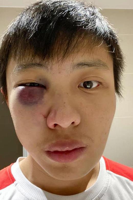 UK teen admits to punching Singapore student in &#039;coronavirus attack&#039;