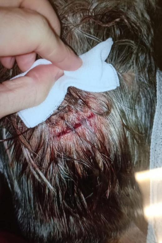 Woman given stitches after hitting head at coffeeshop table