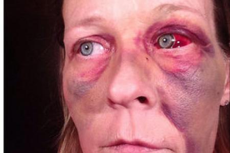 Does this look like love to you? Shocking pictures of domestic violence