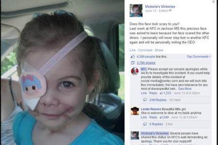 KFC employee allegedly asks 3-year-old to leave because of her scarred face