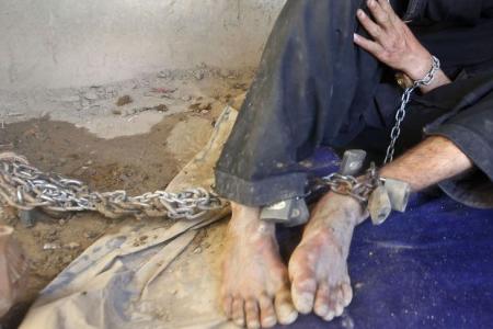 Down syndrome teen chained 24hrs a day