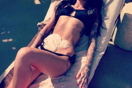 She inspires with bikini shot exposing her colostomy bags