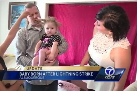 Baby who survived lightning strike has hair that stands