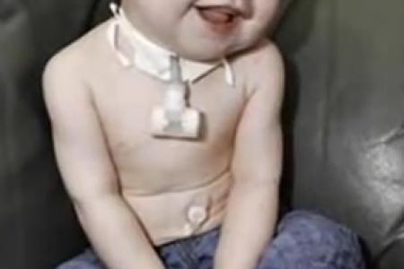 Baby survives seven heart attacks and 20-minute death