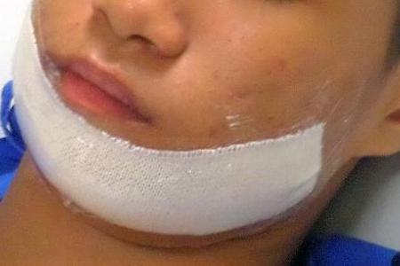 Boy, 14, suffers broken jaw from beating by two older schoolmates