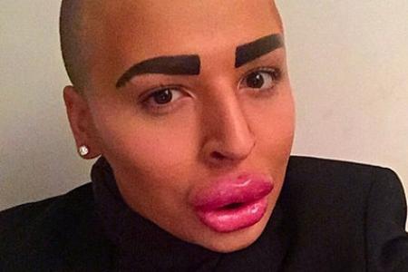 Man spends S$197,000 in cosmetic surgeries to look like Kim Kardashian