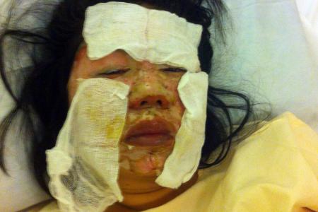 Exploding hotpot: Woman badly scalded at Beach Road restaurant