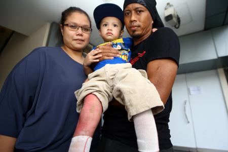 Parents of toddler scalded by hot oil get special visitors