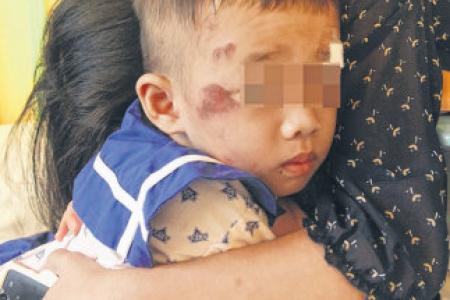 Cyclist crashes into boy, 3, outside childcare centre