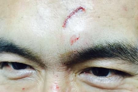 Adrian Pang cuts head during LKY Musical, continues with blood dripping down his face