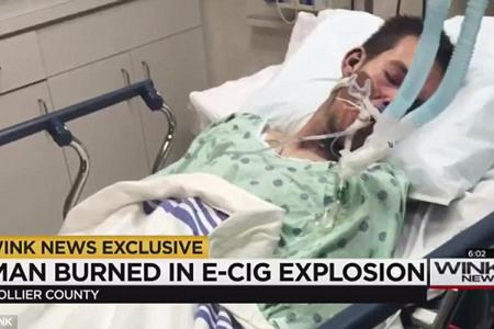 E-cigarette blows up in his face