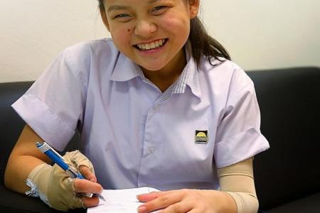 Girl who lost fingers clears N-level exams