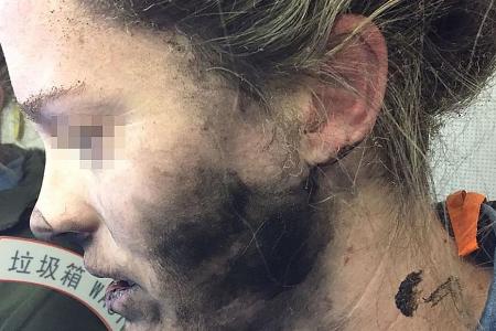Woman burnt after her headphones explode on flight