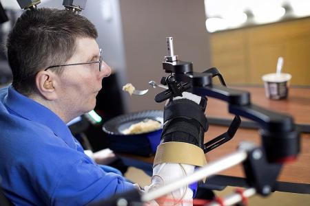 Technology allows paralysed man to move arm