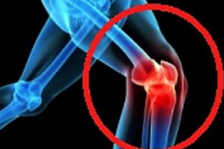Cracking, popping joints may foretell arthritis 