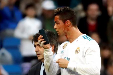Ronaldo: Vain even when in pain