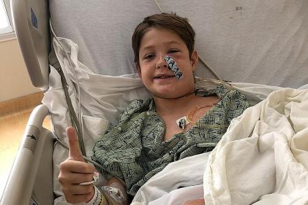 US boy, 10, recovering after falling face-first onto skewer