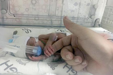 UK couple’s baby born 16 weeks early