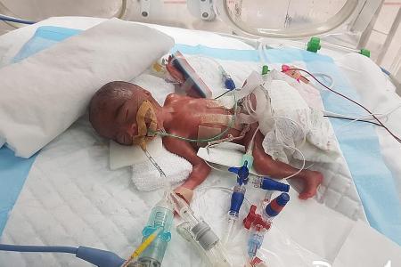 Baby who weighed 345g at birth is now a &#039;hefty&#039; 4.27kg