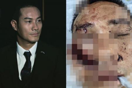 Actor Jason Wong gets over 100 stitches after 'mistaken identity' attack in restaurant