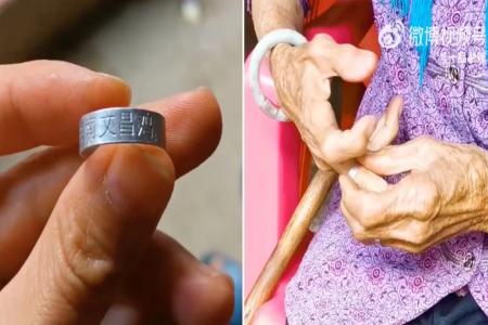 Woman in China wore chicken leg band for years thinking it was a ‘silver ring’