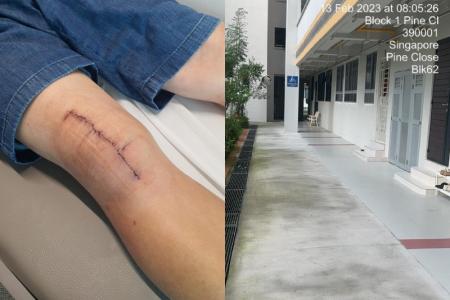 Man slips and breaks kneecap after fall along HDB corridor; contacts town council over slippery surface