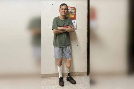 Actor Duan Weiming fitted with prosthetic leg