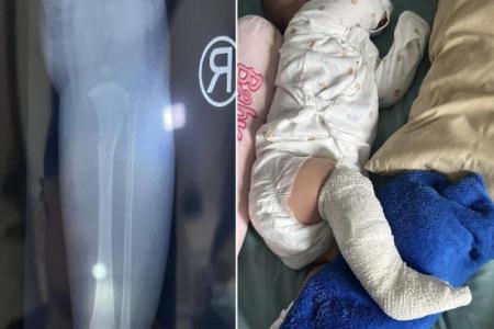 Woman in M'sia cautions others after claiming nanny broke her newborn's leg