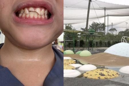 Boy breaks two front teeth after accident at Bird Paradise playground