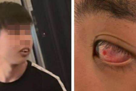 Student claims he was punched in the eye at Chijmes