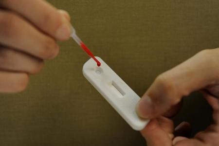 HIV disclosure law to be amended