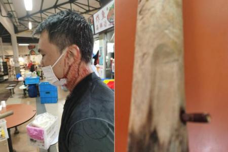 Tanglin Halt hawker has skull fracture, blood clot in brain after alleged attack