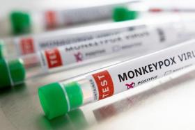Spain says 4,298 cases of monkeypox have been confirmed in the country.