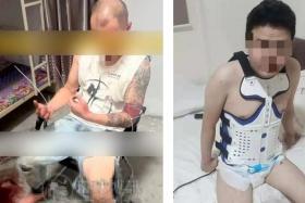 A Taiwanese man forced to work at a scam compound in Cambodia is seen being tortured (left), while a Chinese victim (right) was injured after jumping from the fourth floor of a Cambodian scam compound.
