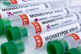 Globally, there are now more than 5,000 cases of monkeypox.