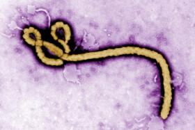 Some of the ultrastructural morphology displayed by an Ebola virus virion is revealed in this undated handout colorized transmission electron micrograph (TEM). 