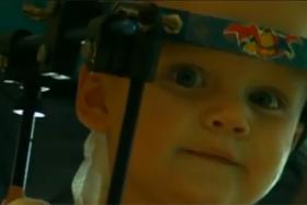 Jaxon Taylor, whose neck and head were detached, now has to wear a halo so that the bones will fuse properly.