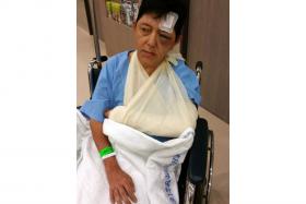 HURT: Mr Leong Kok Cheong was taken to Changi Hospital after a robbery left him with a swollen left eye, a broken left arm and other injuries.