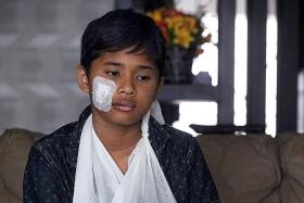 INJURED: Raiyan, from East Spring Primary School, fractured his right arm and suffered a major cut on his cheek. 