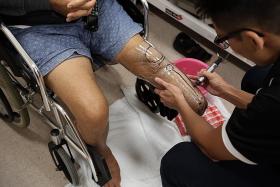 Prompt treatment can save limbs