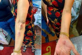 Madam Hindocha Nita Vishnubhai sustained injuries on her arms and hands after the incident last Friday in Choa Chu Kang. 