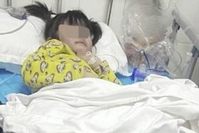 5-year-old girl in China allegedly beaten, burnt by father and his girlfriend