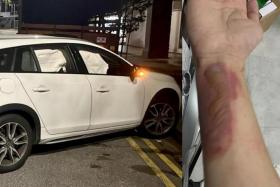 Business owner Jason (not his real name) said the impact of the accident was strong enough to inflate the car&#039;s airbags. He suffered serious abrasions on his hands.