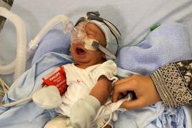A month after he was born at Thomson Medical Centre, Nurfattah Bin Nurfahmy was diagnosed with a rare disease known as Arthrogryposis Multiplex Congenita (AMC).