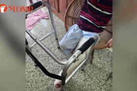 The woman shared a photo of her father's left leg in a cast with a walking frame on TikTok.