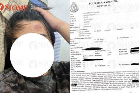 3 S'poreans allegedly attacked by men with chairs and robbed in JB: 'I still have PTSD'