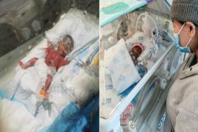 Premature baby requires machine to breathe, parents start fundraiser to pay for bills