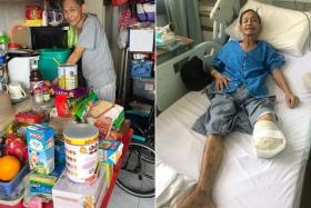 Duan Weiming at home (left) after being discharged from hospital. His left leg was amputated below the knee.