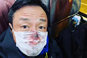 Hong Kong actor Wong He posted photos of his blood-stained face mask on social media.